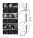 Fig. 06 - Composition and method for treating neuronal ceroid lipofuscinosis