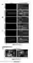 Fig. 09 - Composition and method for treating neuronal ceroid lipofuscinosis