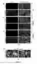 Fig. 10 - Composition and method for treating neuronal ceroid lipofuscinosis