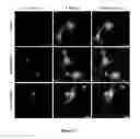 Fig. 16 - Composition and method for treating neuronal ceroid lipofuscinosis