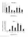 Fig. 02 - Methods of treating portal hypertension