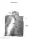 Fig. 02 - COMPOSITIONS AND METHODS FOR HAIR GROWTH