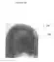 Fig. 09 - COMPOSITIONS AND METHODS FOR HAIR GROWTH