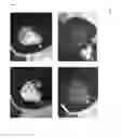 Fig. 06 - Hemostatic foam