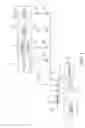 Fig. 02 - System for removing undesirable elements from blood using a first wash step and a second wash step