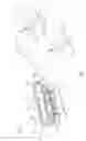 Fig. 02 - Infusion pump systems and methods
