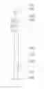 Fig. 04 - NEEDLE BASE RETRACTABLE-TYPE SAFE SELF-LOCKING-TYPE SELF-DESTRUCTING SYRINGE