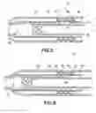 Fig. 04 - Needle mounting feature for ensuring proper reconstitution sequence
