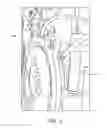 Fig. 04 - DEVICE FOR INTRANASAL ADMINISTRATION