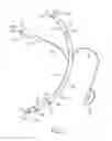 Fig. 02 - TRACHEAL TUBE WITH CONTROLLED-PRESSURE CUFF