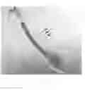 Fig. 07 - Reversible airway device and related method for ventilating a subject
