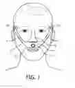 Fig. 02 - PATIENT INTERFACE CUSHION WITH INTEGRAL STRAPS