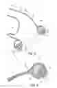 Fig. 07 - RESPIRATORY MASK ASSEMBLY FOR STABILIZING PATIENT INTERFACE