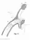 Fig. 08 - RESPIRATORY MASK ASSEMBLY FOR STABILIZING PATIENT INTERFACE