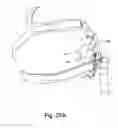 Fig. 20 - RESPIRATORY MASK ASSEMBLY FOR STABILIZING PATIENT INTERFACE