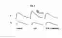 Fig. 03 - Use of magnetic stimulation to modulate muscle contraction