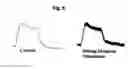 Fig. 07 - Use of magnetic stimulation to modulate muscle contraction