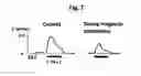 Fig. 08 - Use of magnetic stimulation to modulate muscle contraction