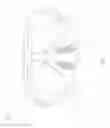Fig. 02 - Mask Structure Without an Inner Waterproof Ring