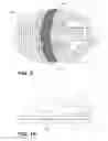 Fig. 09 - Direct contact racquet