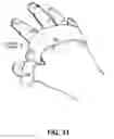 Fig. 35 - Direct contact racquet