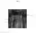 Fig. 03 - Steel for mold, and mold