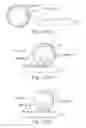 Fig. 10 - DEVICE PRINTING INTENDED PATTERN AND METHOD THEREOF