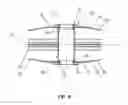 Fig. 07 - Bicycle wheel with unitary side construction
