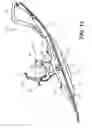 Fig. 12 - Snowmobile ski assembly