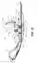Fig. 18 - Snowmobile ski assembly