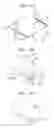 Fig. 12 - WELDED CAN BODY, WELDED CAN, METHOD OF MANUFACTURING WELDED CAN BODY, AND METHOD OF MANUFACTURING WELDED CAN