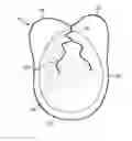 Fig. 01 - Packaging and method of opening