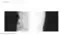 Fig. 03 - Easily tearable adhesive tape