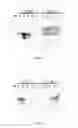 Fig. 02 - COMPOSITIONS AND METHODS FOR HANDLING POTENTIAL PRION CONTAMINATION