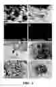 Fig. 02 - Method for inhibiting calcification of a macrophage-derived matrix vesicle