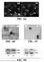 Fig. 07 - Method for inhibiting calcification of a macrophage-derived matrix vesicle