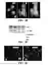 Fig. 08 - Method for inhibiting calcification of a macrophage-derived matrix vesicle