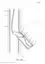 Fig. 09 - A DOWNHOLE TOOL AND DOWNHOLE SYSTEM