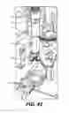 Fig. 41 - AUTOMATED DECK BUSHING SYSTEM