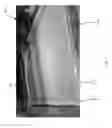Fig. 08 - Extended shale shaker screen handle(s)
