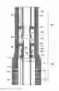 Fig. 01 - Completion system having a sand control assembly, an inductive coupler, and a sensor proximate to the sand control assembly