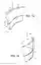 Fig. 02 - Stator vane formed by a set of vane parts