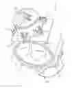 Fig. 01 - Flapper assembly for a throttle valve
