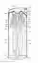 Fig. 01 - Scroll compressor and method for assembling a scroll compressor