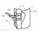 Fig. 01 - SIPHON TUBE