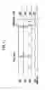 Fig. 12 - Brake drive control device provided with abnormality detection function