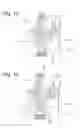 Fig. 08 - Torsional vibration damper
