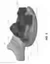 Fig. 04 - Quick release bite mount