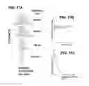 Fig. 12 - Analysis of bioparticles in an optical microcavity
