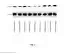 Fig. 07 - PROGRANULIN AS MARKER FOR AUTOIMMUNE DISORDERS